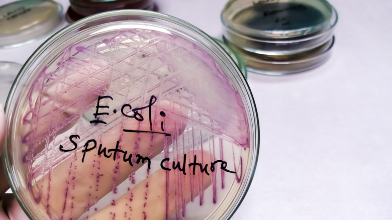 E. coli culture in glass dish.