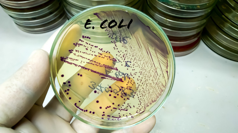 E. coli in a petri dish