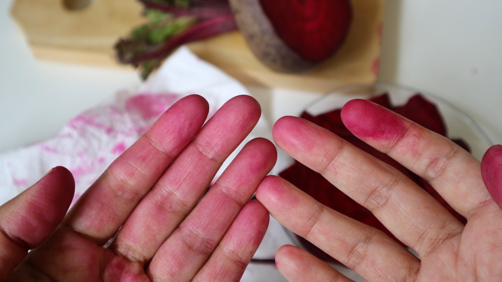 5 Quick Tricks To Remove Beet Stains From Your Hands
